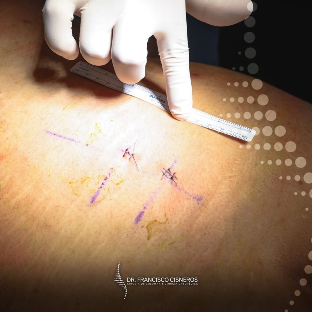 468445437 18332463451159869 4318372244303360295 n Traumatologo Ortopedista en Tijuana https://drcisnerosortopedia.com