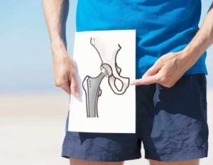 cirugia protesis de cadera traumatologo en tijuana