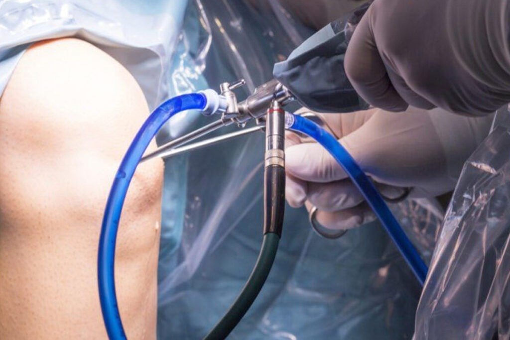 Artroscopia de Rodilla en Tijuana BC Traumatologo Ortopedista en Tijuana https://drcisnerosortopedia.com