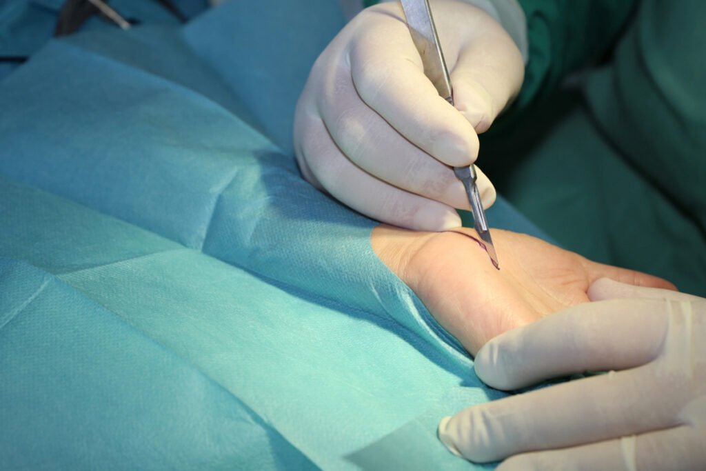 Cirugia de Muneca en Tijuana Traumatologo Ortopedista en Tijuana https://drcisnerosortopedia.com