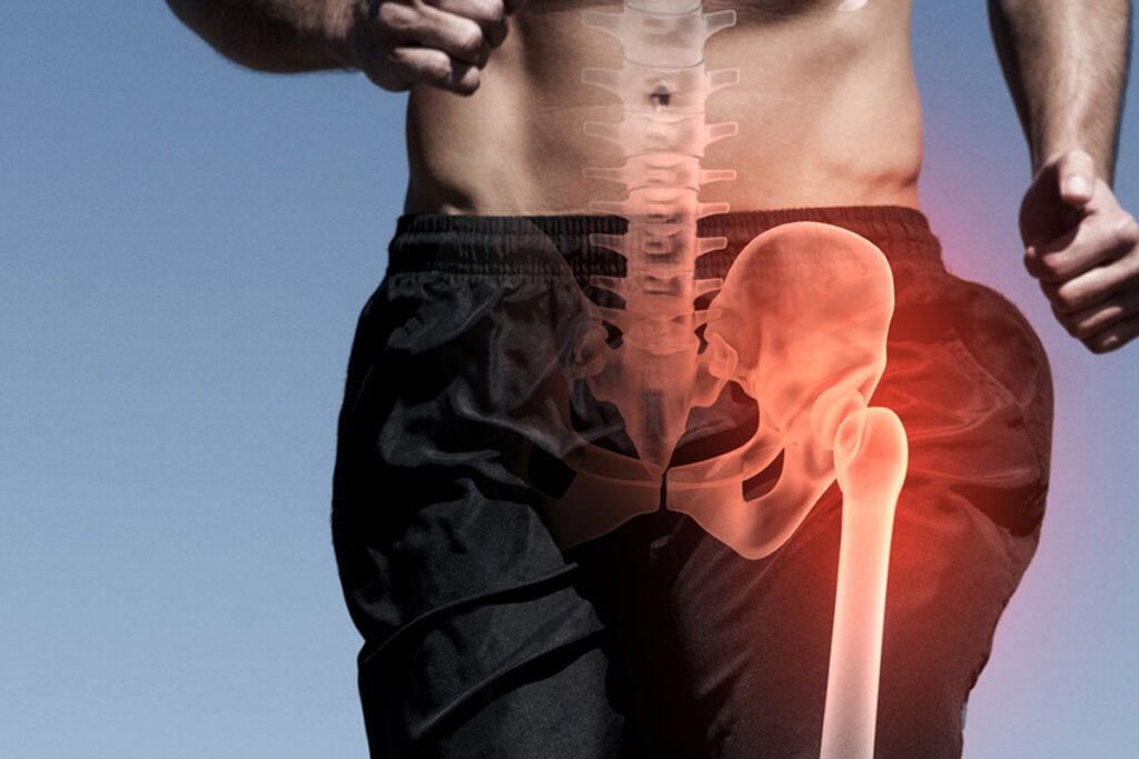 Fractura de Cadera en Tijuana Traumatologo Ortopedista en Tijuana https://drcisnerosortopedia.com