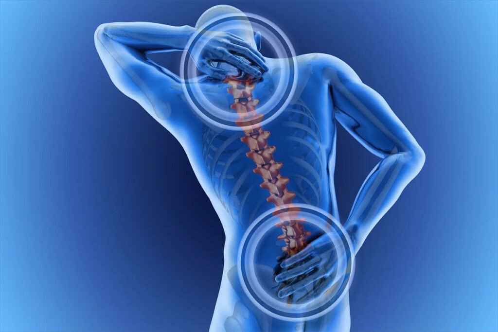 Fractura de Columna en Tijuana Traumatologo Ortopedista en Tijuana https://drcisnerosortopedia.com
