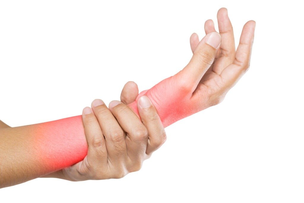 Fractura de Muneca en Tijuana Traumatologo Ortopedista en Tijuana https://drcisnerosortopedia.com