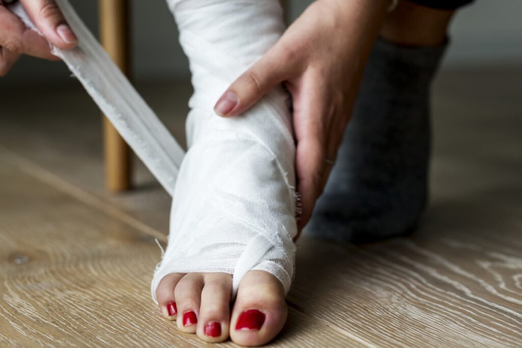 Fractura de Pie en Tijuana Traumatologo Ortopedista en Tijuana https://drcisnerosortopedia.com