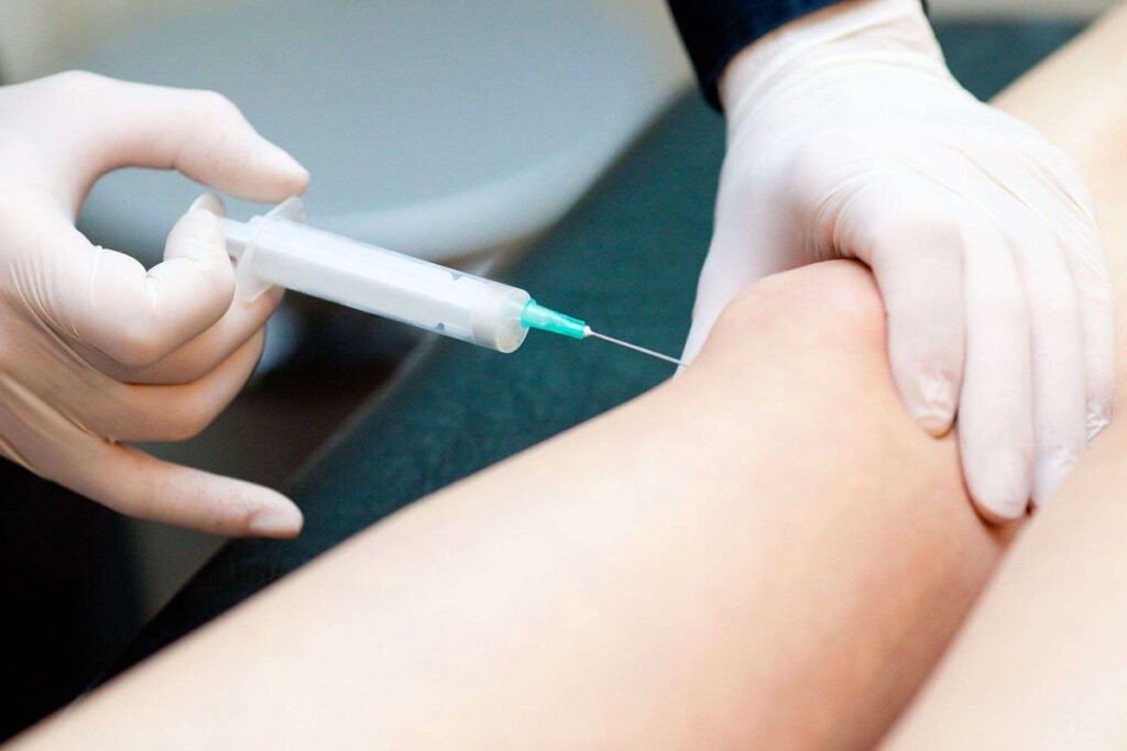 Infiltracion de Rodilla en Tijuana Traumatologo Ortopedista en Tijuana https://drcisnerosortopedia.com