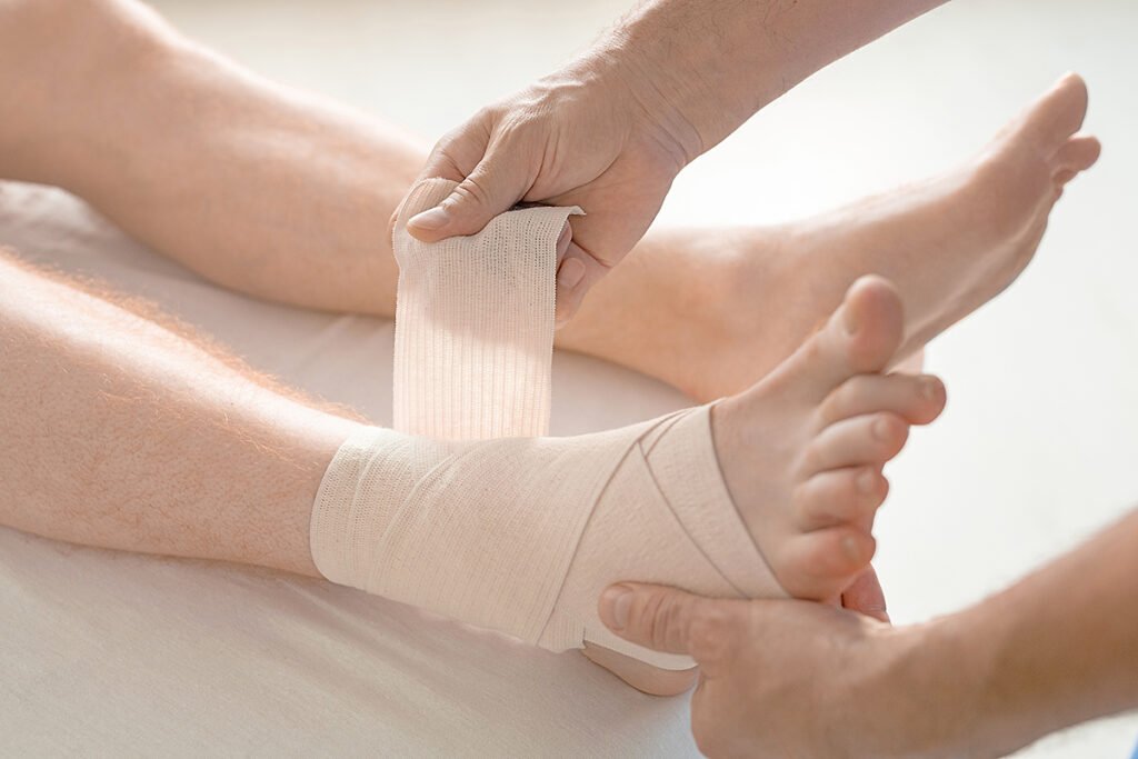 yeso para fractura de tobillo en tijuana Traumatologo Ortopedista en Tijuana https://drcisnerosortopedia.com