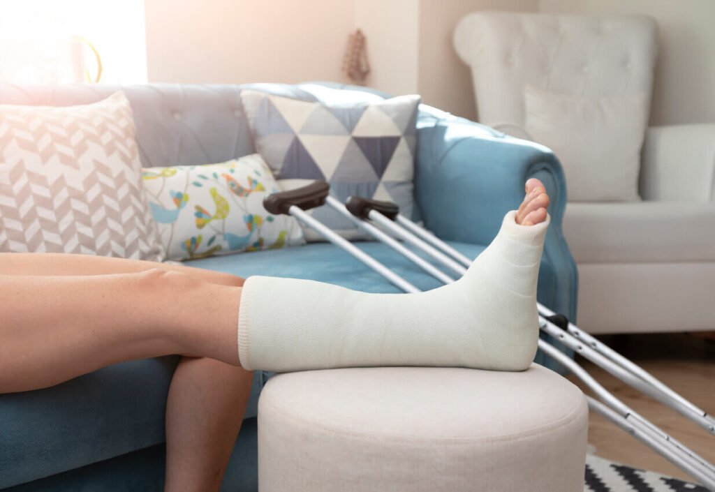 Reposo de Tobillo despues de Cirugia Traumatologo Ortopedista en Tijuana https://drcisnerosortopedia.com